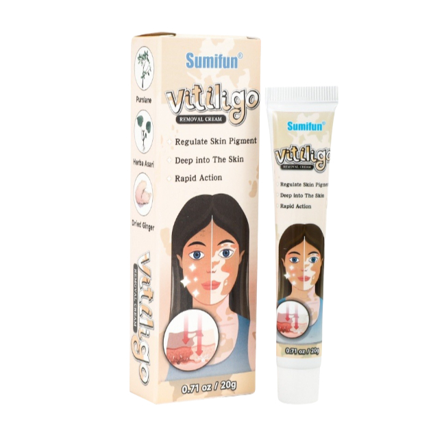 Viti Cream Salep vitiligo, panu, biang keringat, salep panu anti bakteri dengan cepat, musuh panu, m