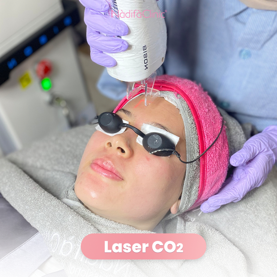 Laser CO2 Fractional