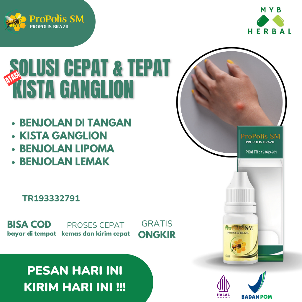 Propolis SM Herbal Tetes Alami Multikhasiat Untuk Mengatasi Kista Ganglion, Benjolan Di Tangan, Peng