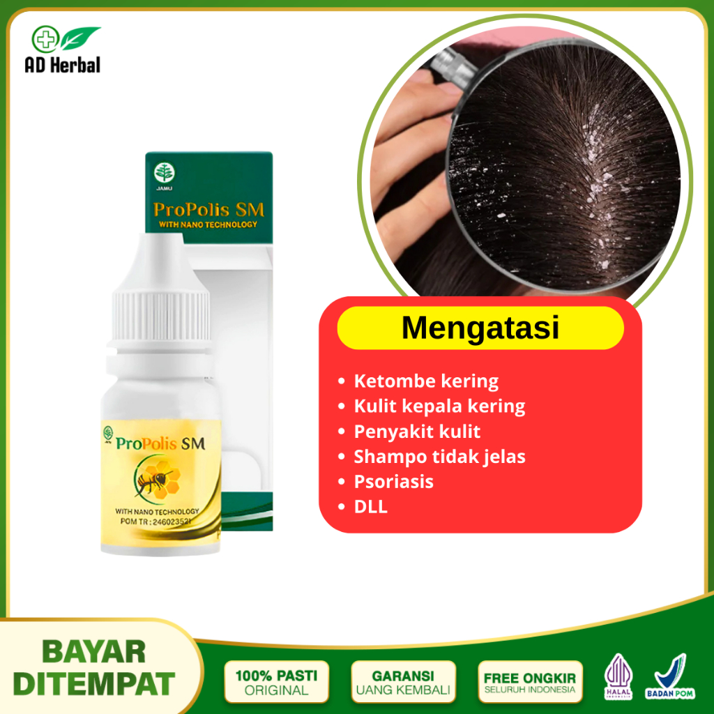 Obat Ketombe Menahun Ketombe Parah Ketombe Berkerak Yang Terlaris Propolis SM