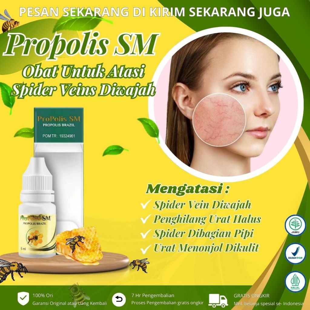 Propolis Sm - Obat Penghilang Spider Veins, Penghilang Urat Halus di Wajah, Anti Spider Veins, Obat 