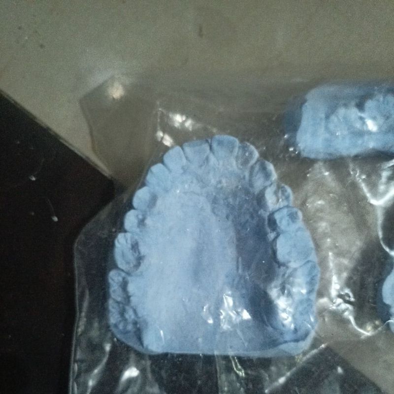 model gigi gipsum bagian atas