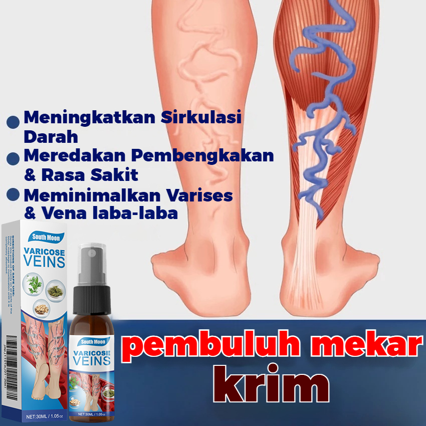 Penghilang varises, penghilang varises asli yang ampuh, semprotan kaki, semprotan varises kaki, aman