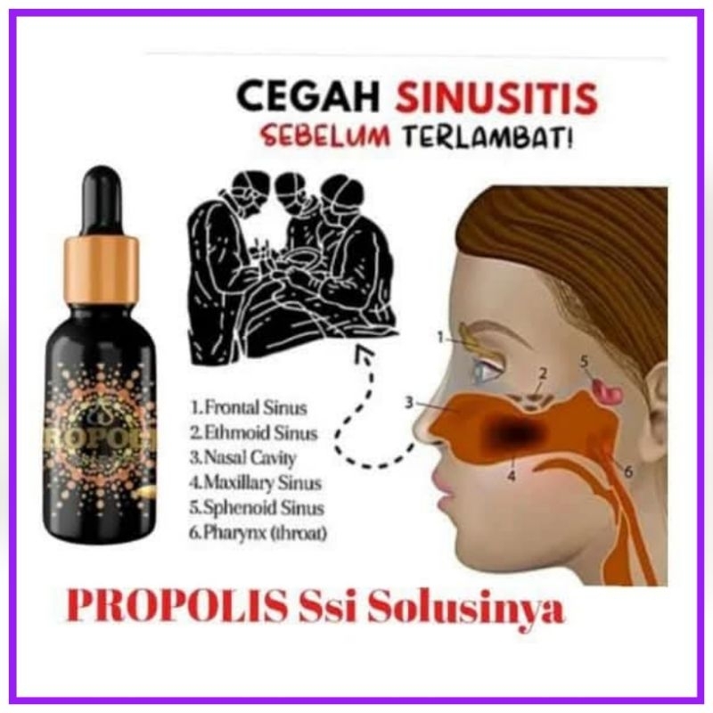 

Propolis Ssi 10 Ml Di Jamin Ori Garansi Uang Kembali Jika Palsu