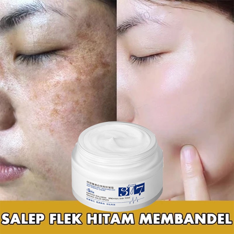 Krim Noda Krim Bintik Hitam Membandel Krim Bintik Hitam Membandel Salep Bintik Hitam 30g Menghilangk