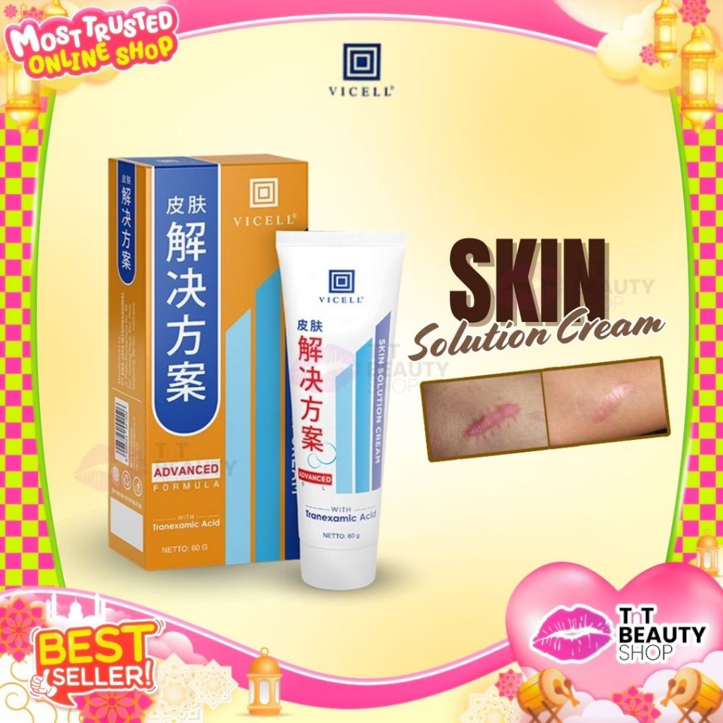 Vicell Skin Care For Scars Solution | TnT Beauty Shop