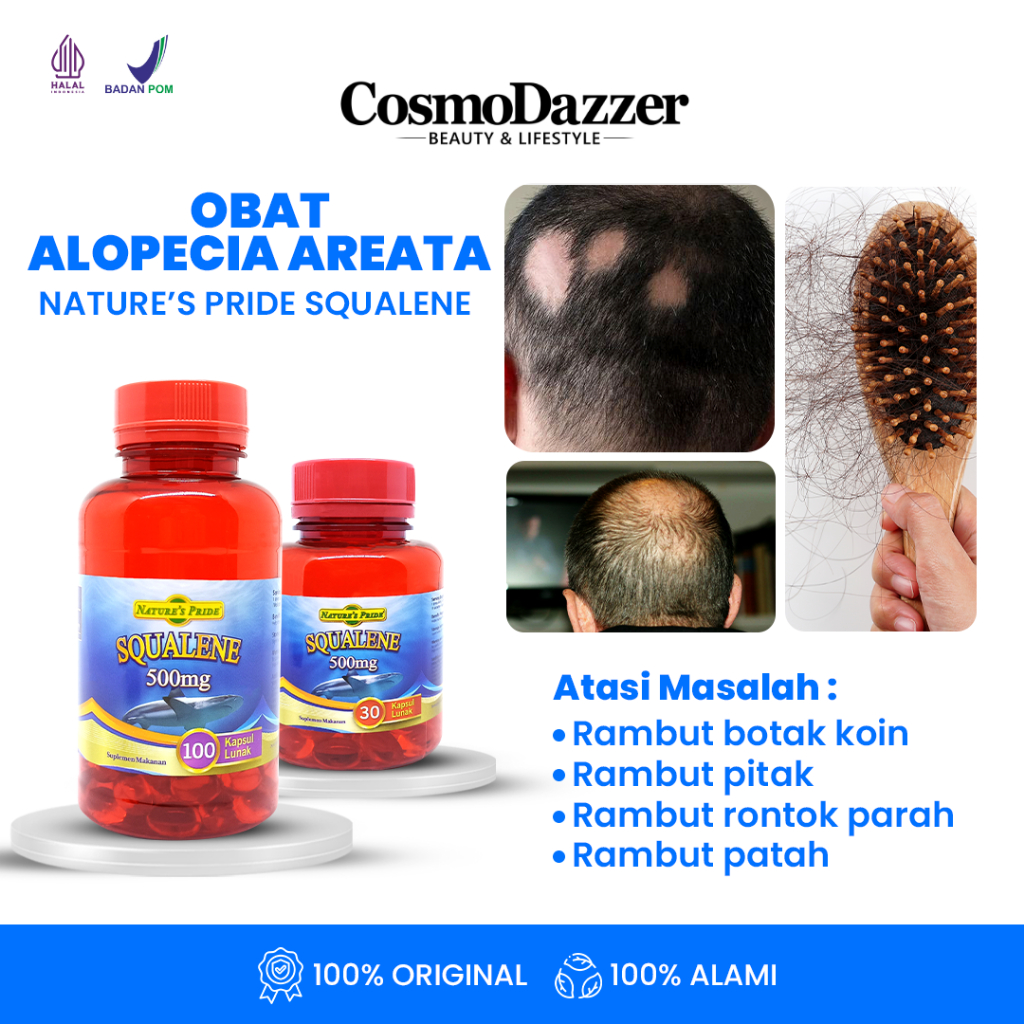 NATURE'S PRIDE SQUALENE 500 MG - OBAT RAMBUT BOTAK, PITAK, RONTOK, DAN ALOPECIA AREATA