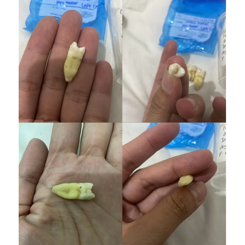 Gigi Geraham Asli / Gigi praktikum / Molar / Gigi Graham