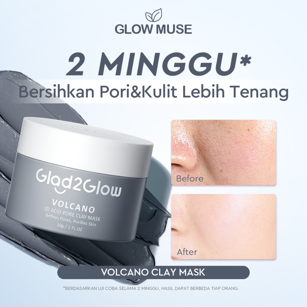 [100% Ori] Glad2Glow Volcano 3D Acid Pore Clay Mask Masker Wajah Blackhead Whitehead Masker Glad2Glo