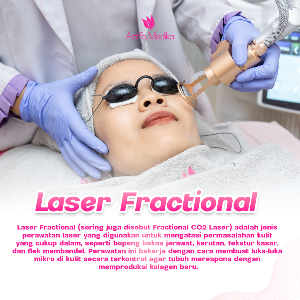 Treatment Laser fractional CO2 Voucher Treatment Azilfa Medika