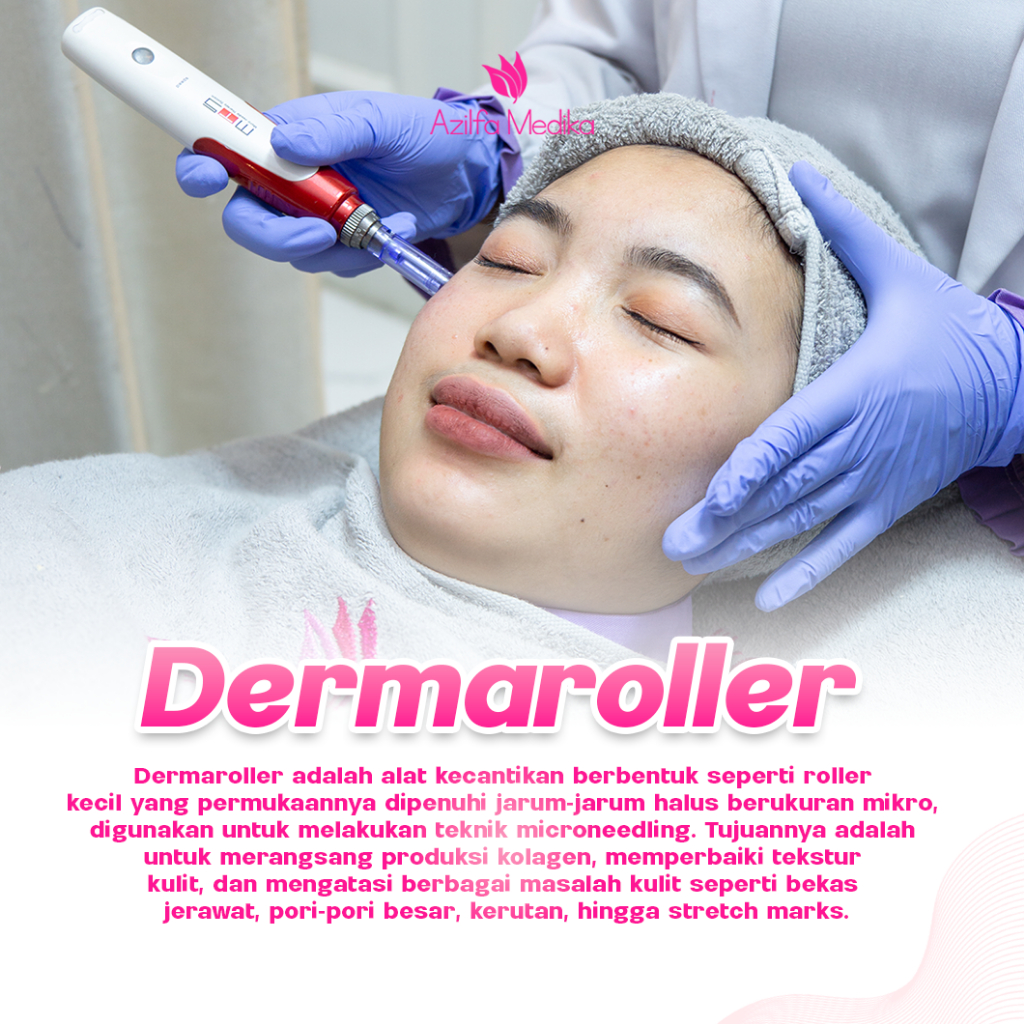 Treatment Dremaroller By Azilfa Medika