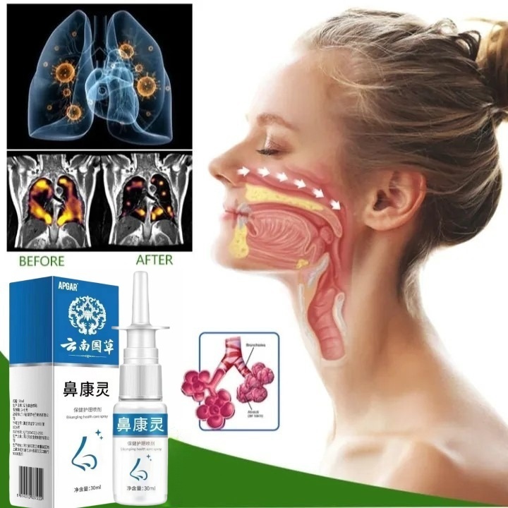 Nasal Spray 30ml Original Sinusitis Spray Obat Sinusitis Hidung Semprot Hidung Tersumbat Semprotan S