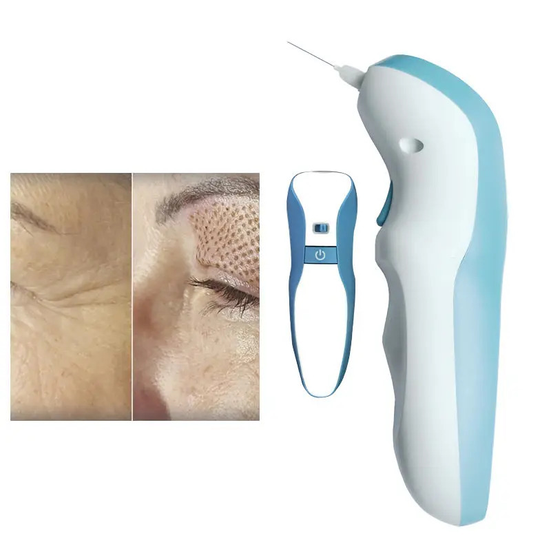 Pena Plasma Fibroblast 2025 Pengangkat Kelopak Mata Profesional Kecantikan