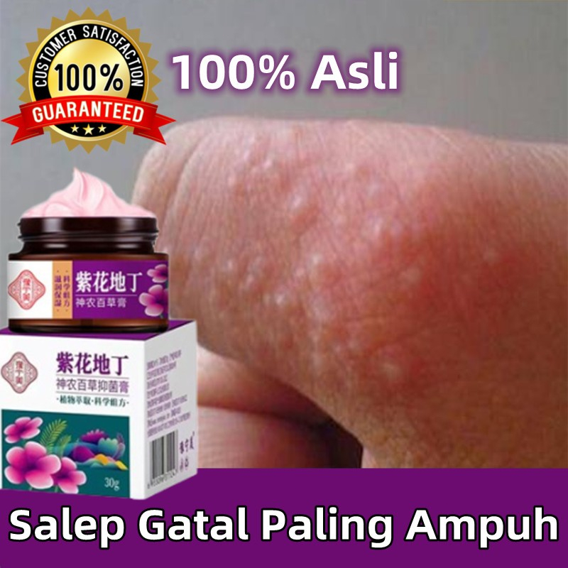 salep gatal paling ampuh Anti jamur Salep salep gatal selangkangan selangkangan Salep gatal pada sal