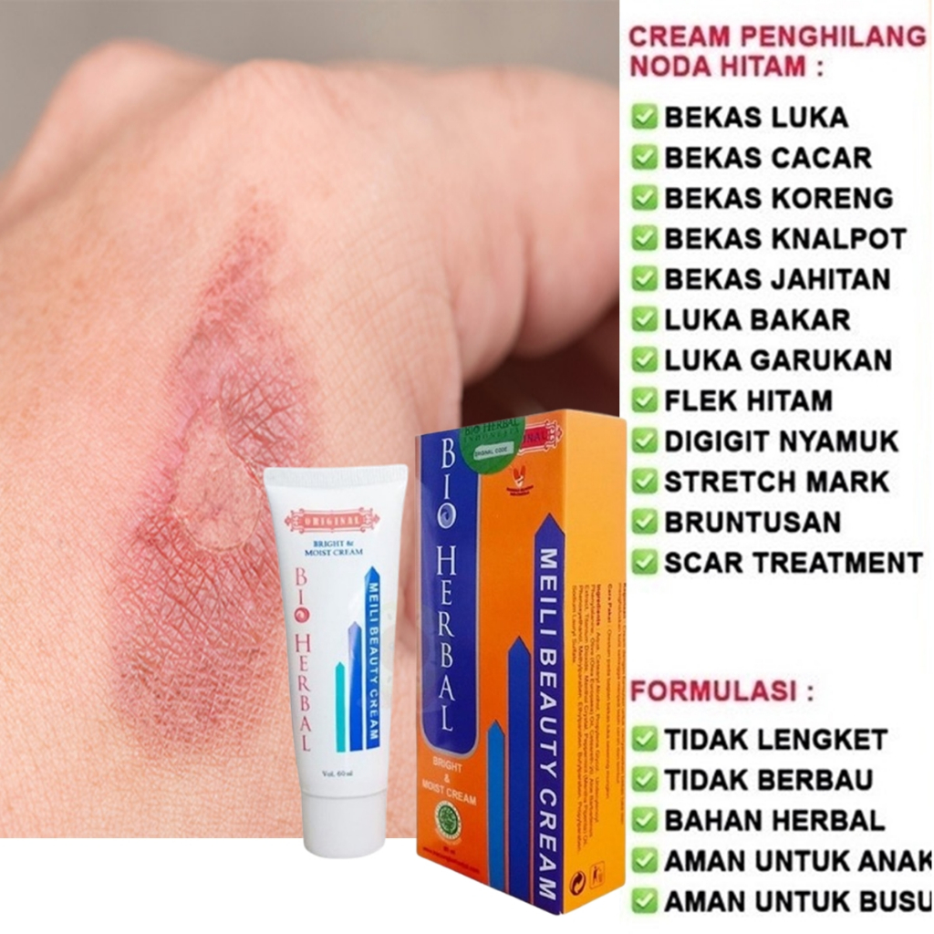 Salep Penyembuhan Luka - Pengering Luka Basah - Luka Agar Cepat Kering - Salep Luka Bakar Kena Knalp