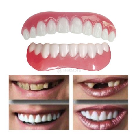 Paket Gigi Palsu Atas Bawah Instan Perfect Smile, Gigi Tiruan