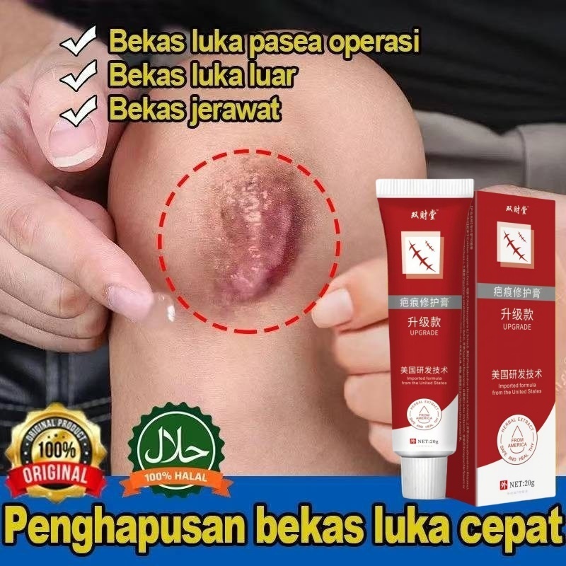 ORI Salep Penghilang Bekas Luka Hitam Koreng Penghilang Bekas Luka Di Kaki Penghilang Bekas Gigitan 