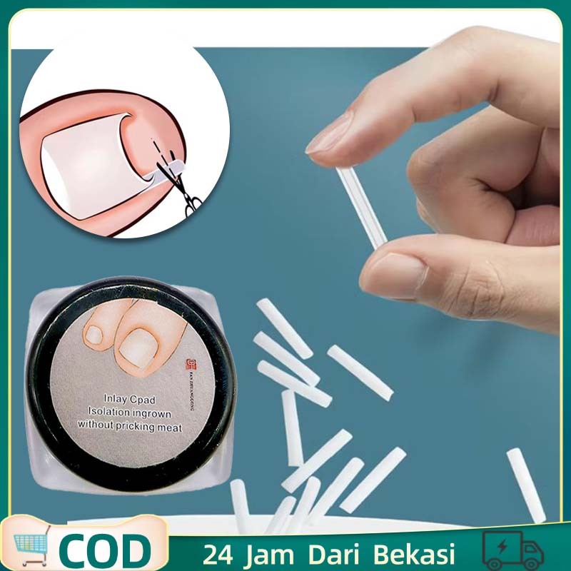 30pcs/1set Bantalan Kuku Nail Art Bantalan Silikon Cantengan Ingrown Nail Silicone Pad Pelindung Kuk