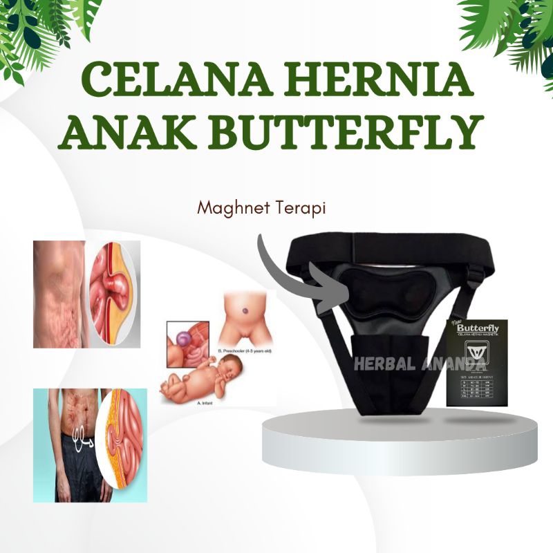 Celana Hernia Anak Butterfly - Penyangga Hernia untuk Bayi & Anak Laki-laki & Perempuan