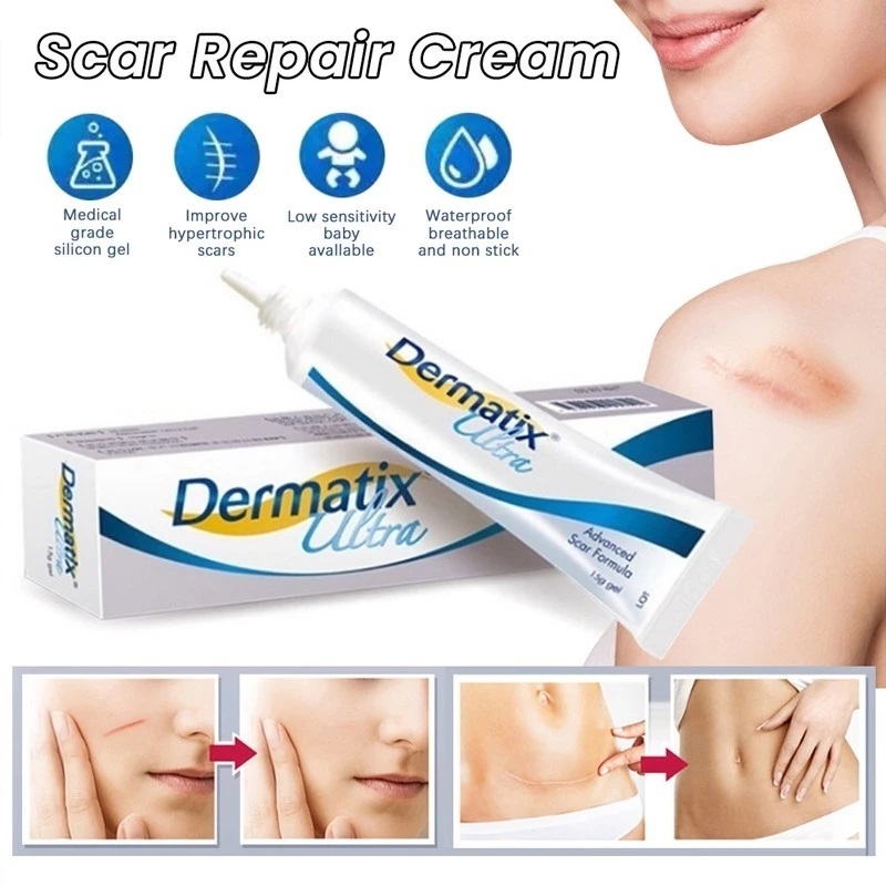 Dermatix Ultra 15gr Original Penghilang Bekas Luka