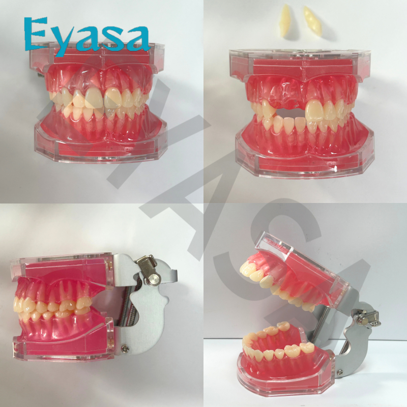 Dental Model Study Studi Gigi Lepasan Phantom Pantum Gigi Lepas Rubber MDY