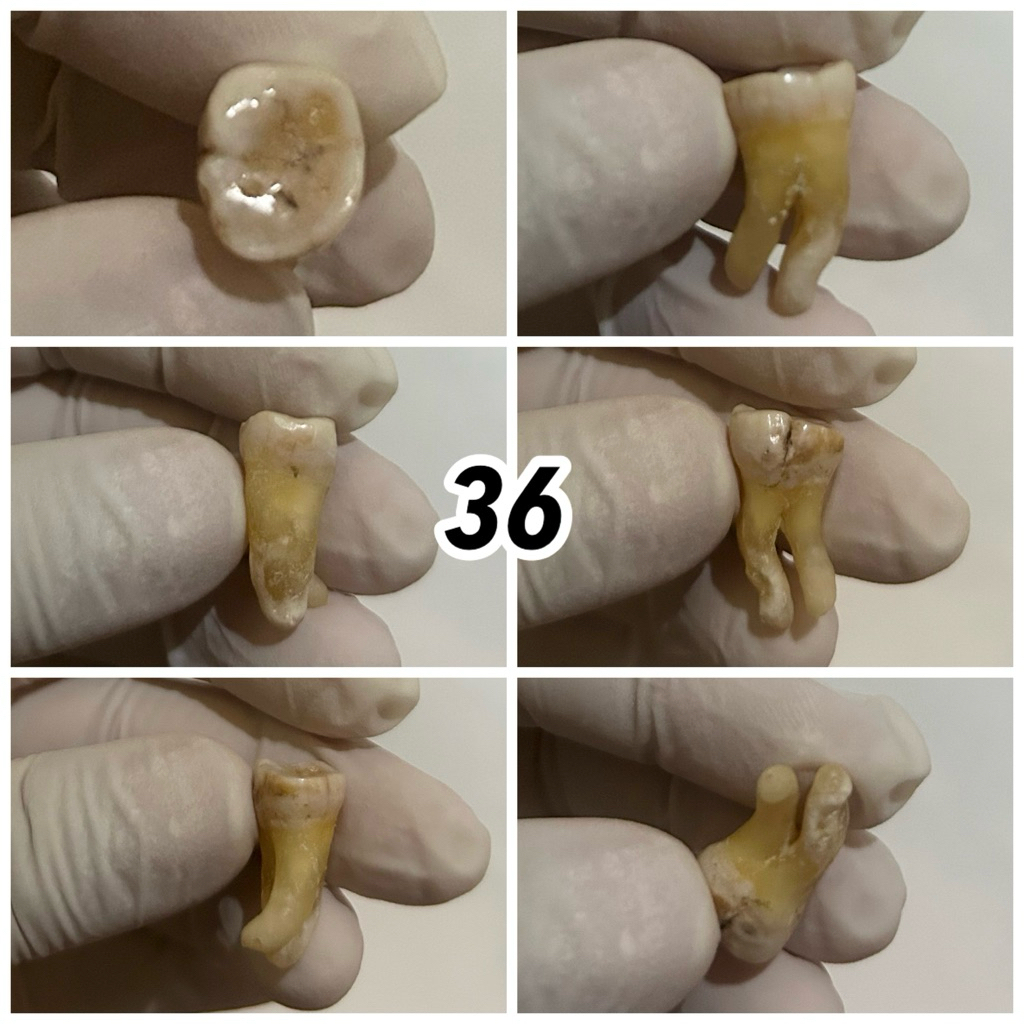 JUAL GIGI ASLI PRAKTIKUM / GIGI MANUSIA / KEDOKTERAN GIGI