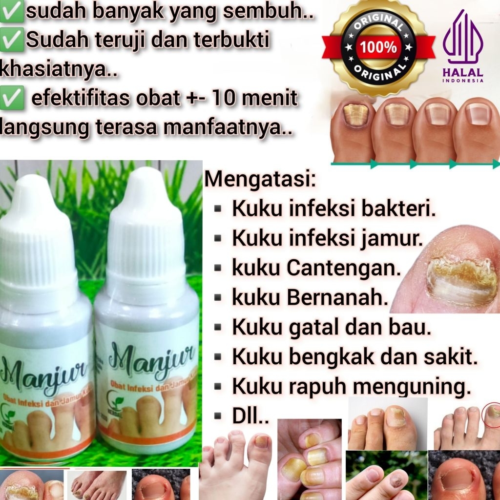 Nail Serum Obat Kuku Cantengan Infeksi Jamur Bakteri Sakit Bengkak Menguning Menebal Bernanah Bau Ga