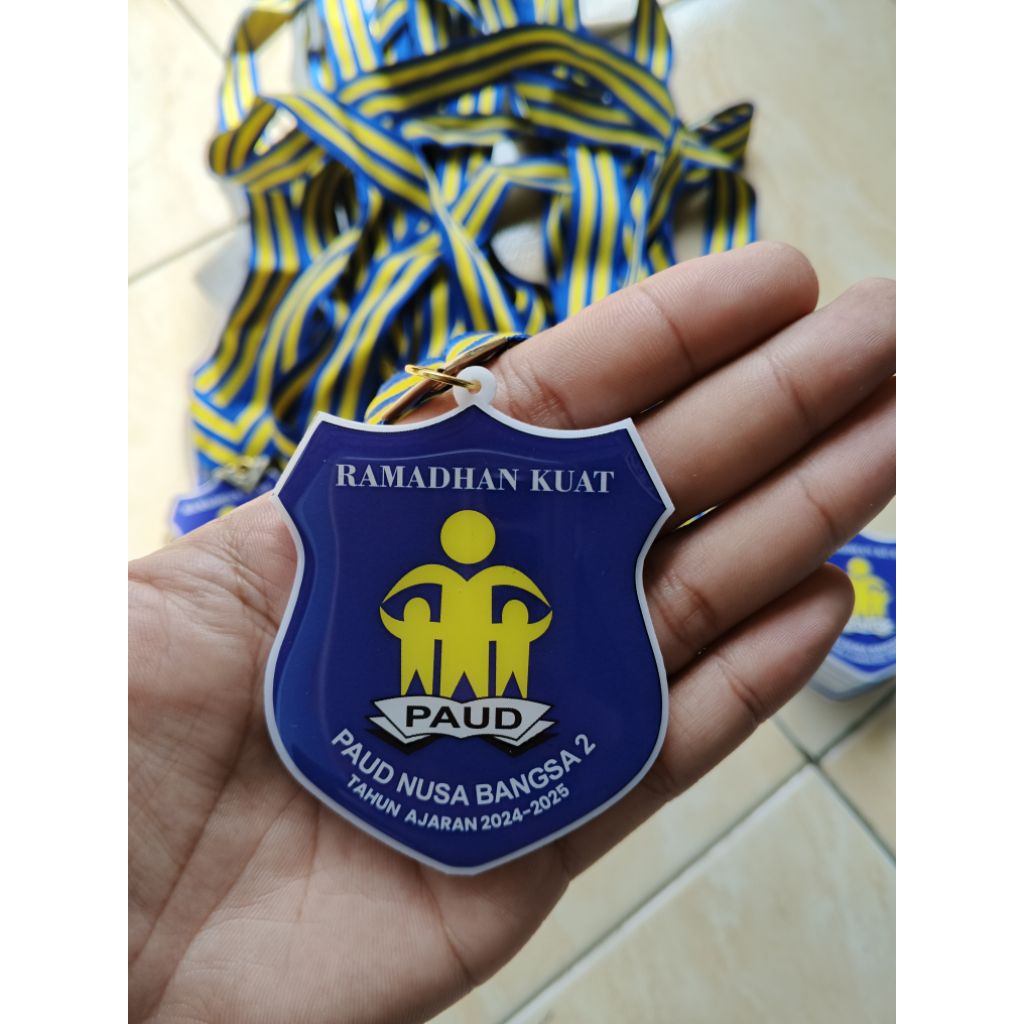 Medali Wisuda Akrilik Resin Custom Medali Perpisahan Medali Kelulusan Medali Juara Resin
