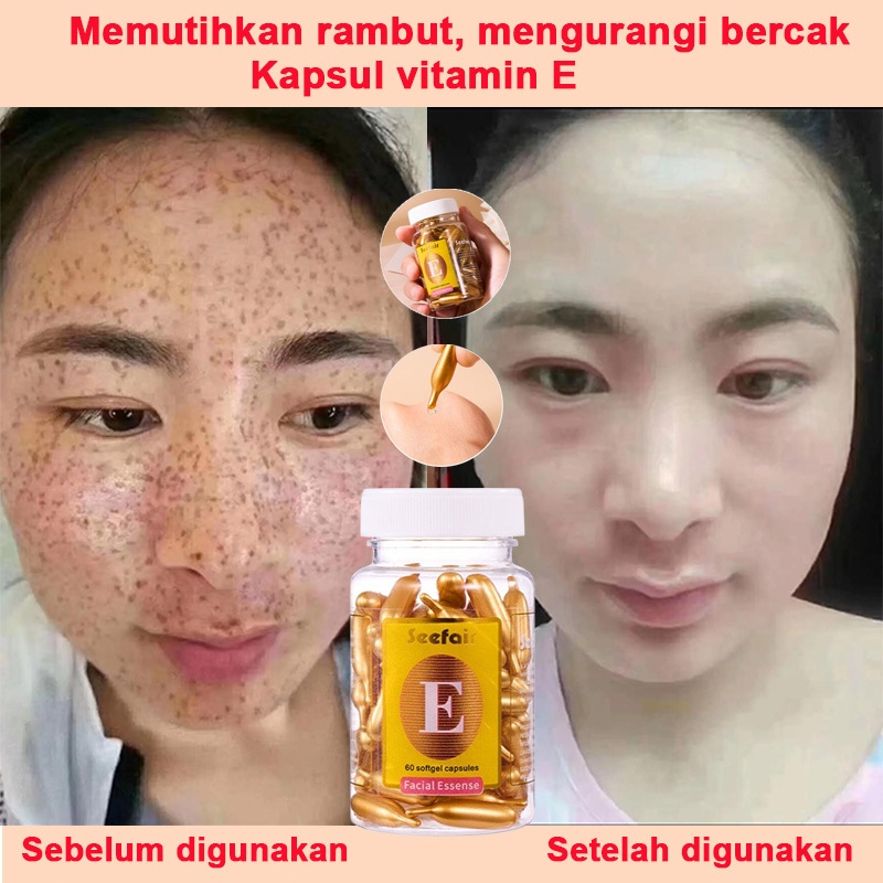 Vitamin E Serum 60 Kapsul Esensi menghilangkan flek hitam di wajah penghilang flek hitam di wajah me