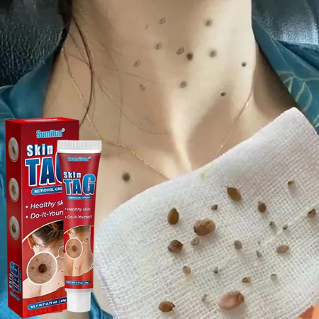 Jepang 0bat Mata Ikan Di Kaki Penghilang Mata Ikan Di Tangan Foot Corn Removal Plester