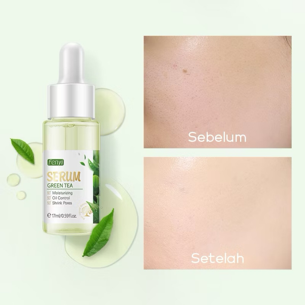 Fenyi Green Tea Serum 17ml –  – BPOM – Mengencangkan Pori, Menenangkan Jerawat, Melembapkan Kulit