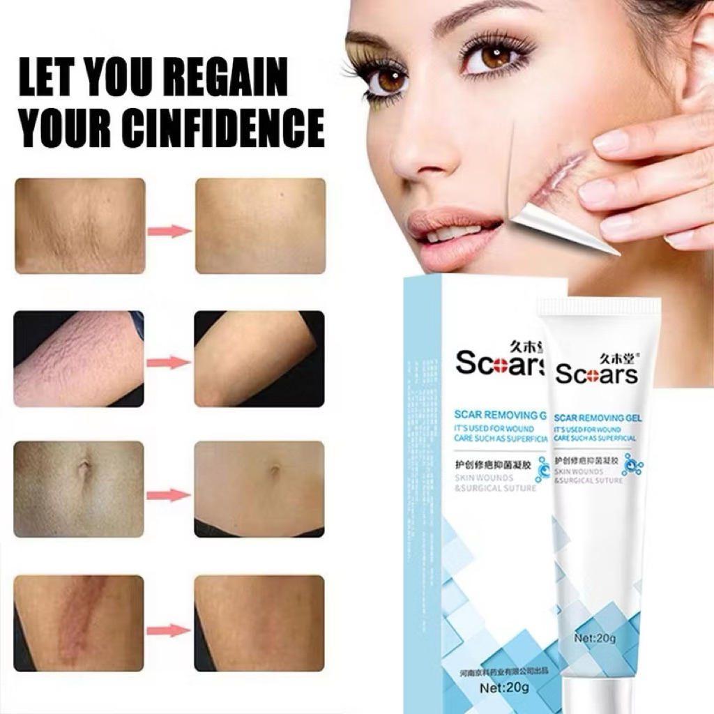 Obat Penghilang Bekas Luka Lama, Cacar, Koreng, Keloid, dan Bekas Gatal | Salep Penghilang Noda Hita