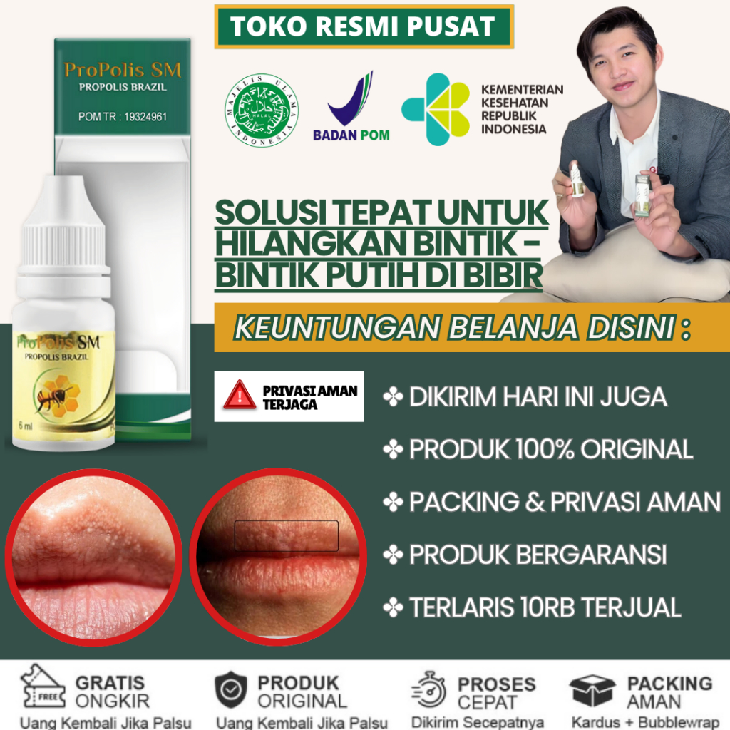[Bisa Cod] Obat Bintik Bintik Putih di Bibir Obat Oles dan Konsumsi Penghilang Bintik Putih di Bibir