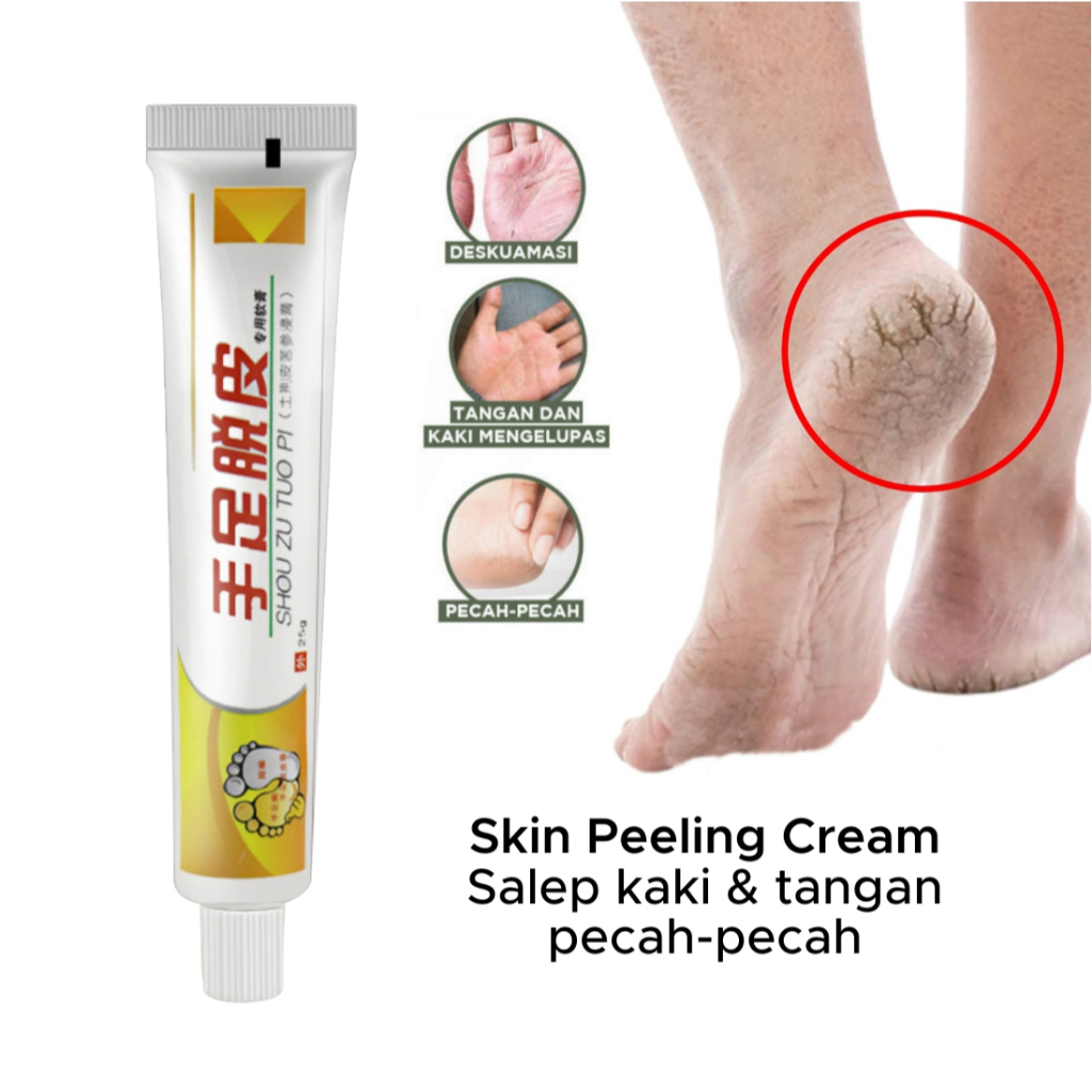 Salep Kaki Pecah Pecah dan Kering Skin Peeling Cream Tangan Anti Keriput / Obat Tumit Kasar Kapalan