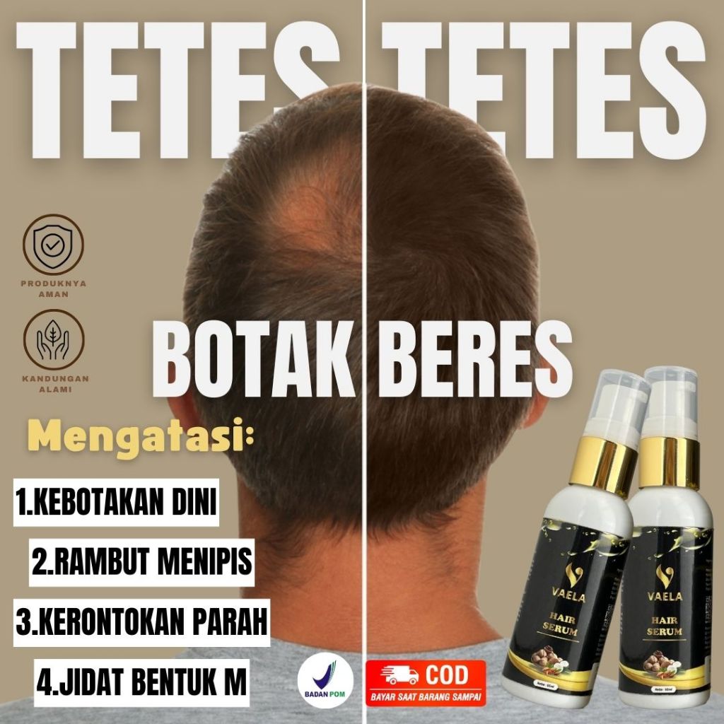VAELA Hair Serum - Bantu Menumbuhkan Merawat Menyuburkan Memperkuat Rambut Mengurangi Kerontokan