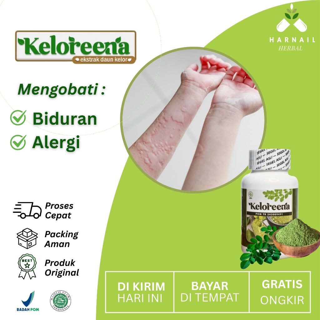 Keloreena Herbal – Atasi Biduran, Alergi & Gatal Badan