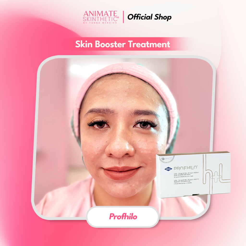Animate Skin Booster - Profhilo