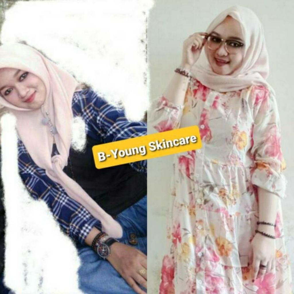 B-Young lotion pkt lngkp 100ml booster 30gr