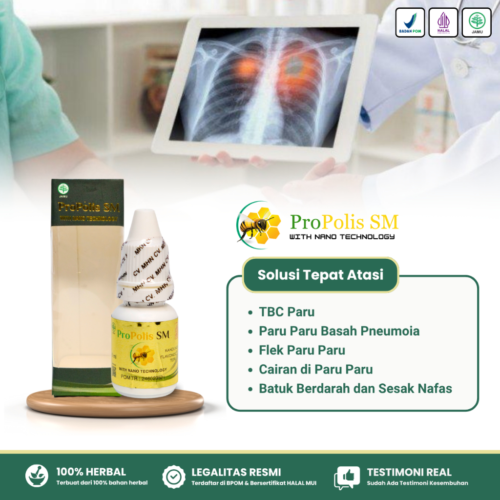 Obat Flek Paru Paru, Pembersih Paru Paru, Penghilang Cairan di Paru Paru Anak & Dewasa Propolis SM