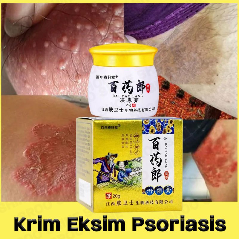 Salep Exim Gatal Eksim Paling Ampuh Salap Kurap 0bat Gatal Di Selangkangan Badan Meredakan Miss V Ga