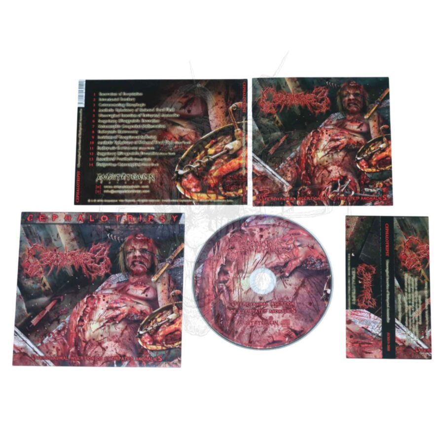 CD – CEPHALOTRIPSY – Uterovaginal Insertion Of Extirpated Anomalies