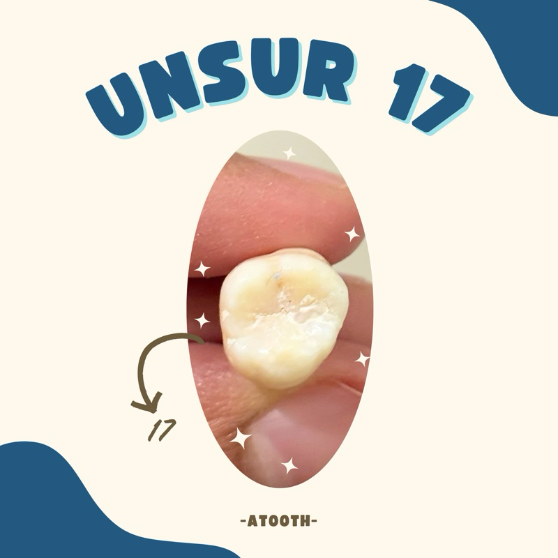 Unsur Gigi Praktikum 17