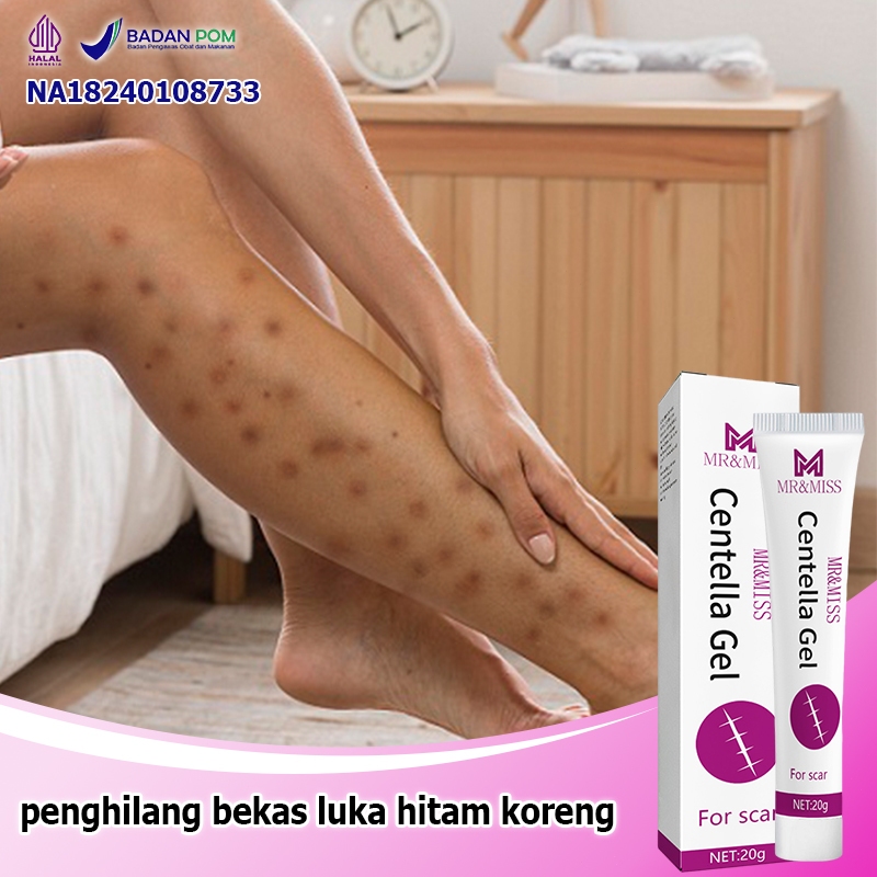 Cream penghilang bekas luka koreng Menghilangkan bekas luka Salep penghilang bekas luka hitam Salep 