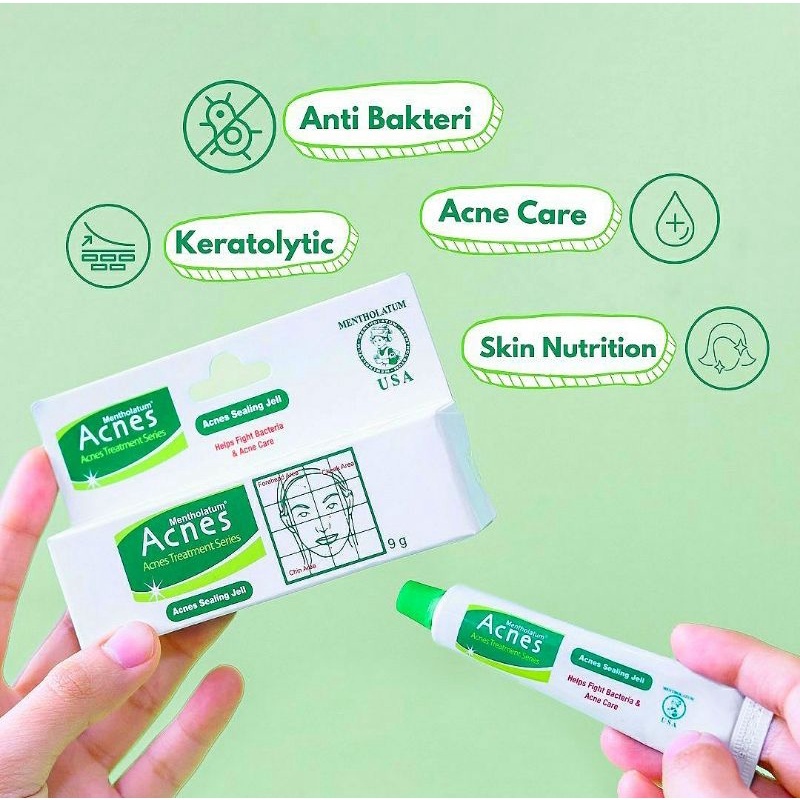 ACNES TREATMENT SERIES