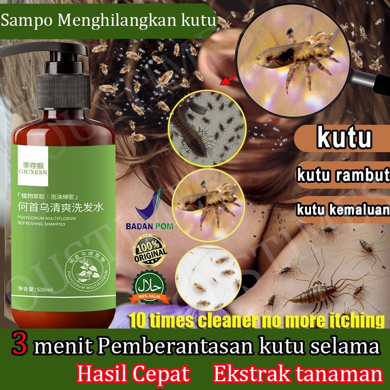 Shampo Kutu Rambut Anak dan Dewasa anti kutu 500ml Shampo Kutu Rambut Anak dan Dewasa shampoo anti k