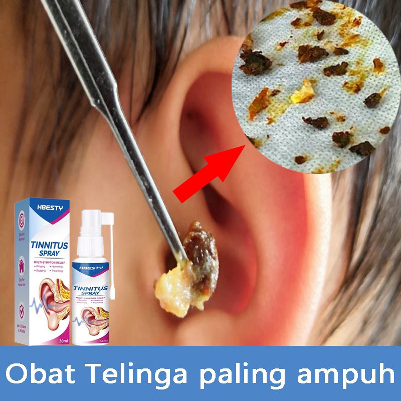 Cairan pembersih telinga pembersih kotoran telinga Pengobatan sakit telinga telinga berdenging Telin