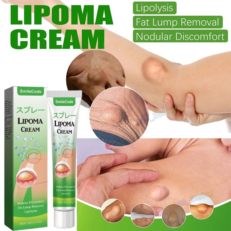 𝗢𝗥𝗜𝗚𝗜𝗡𝗔𝗟 𝗦𝗨𝗠𝗜𝗙𝗨𝗡 LIPOMA CREAM Obat Salep Benjolan Lipoma Obat Benjolan Obat Uci Uci Benjolan Payudar