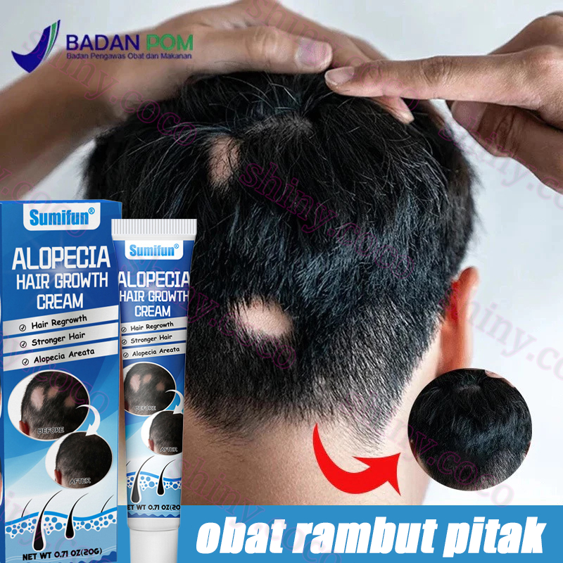 Penumbuh rambut botak cream penumbuh rambut cream  20G penumbuh rambut bayi Pertumbuhan rambut Menst