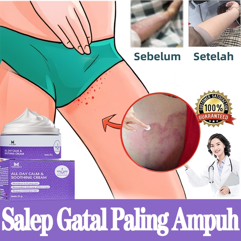 Salep gatal selangkangan Salep gatal eksim paling ampuh Obat gatal paling ampuh 20g Salep gatel Sale