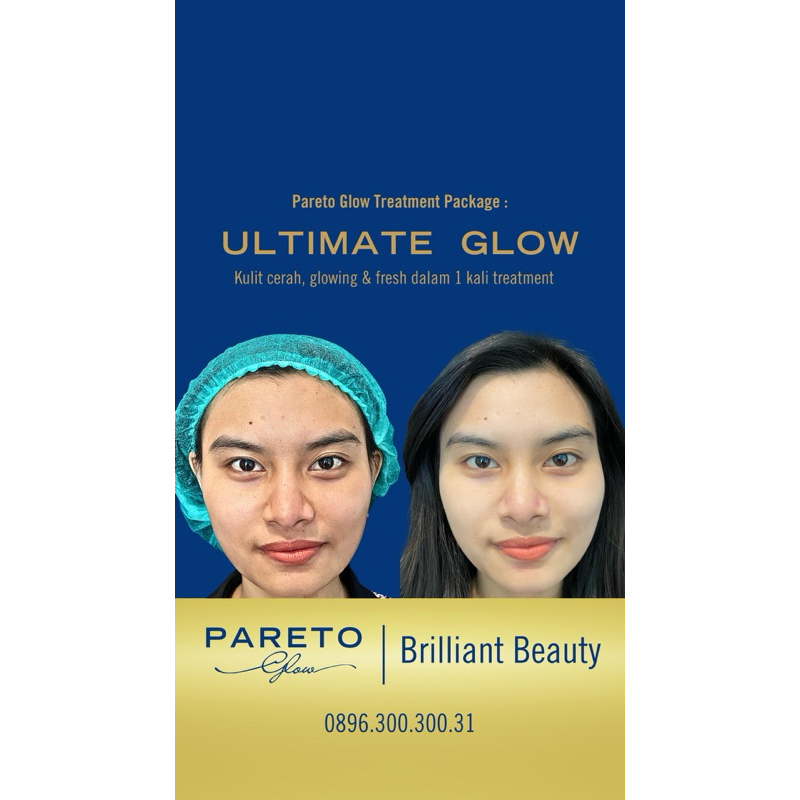 Ultimate Glow